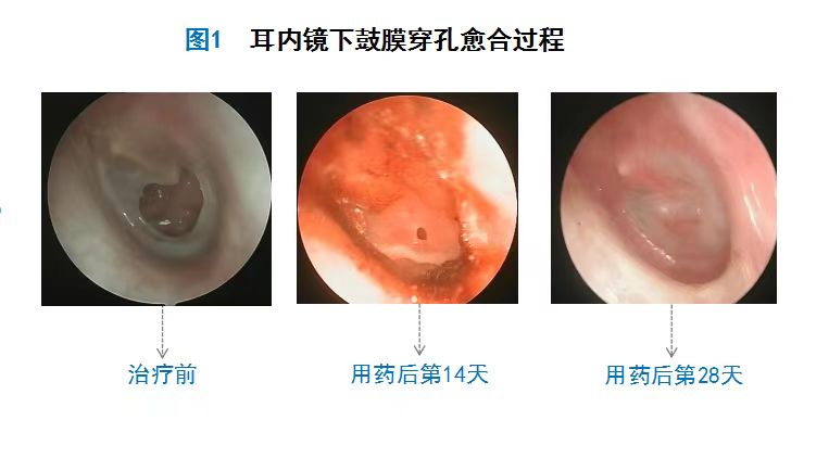 治疗前后对比-白小玲.jpg