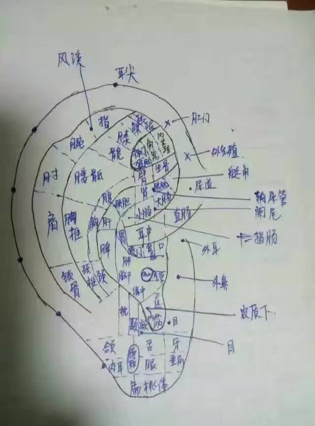 笔探查敏感  一般双耳同贴,也可以交替贴,连续治疗4次(一个月时间),也